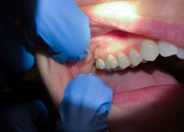 Best Pediatric Emergency Dentist in Rural Hill, TN