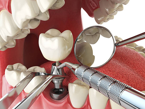 Best Emergency Dentist for Special Needs Patients in Rural Hill, TN